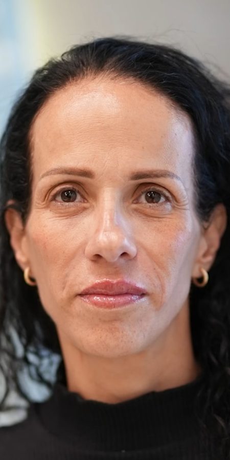 ריענון והצערת הפנים